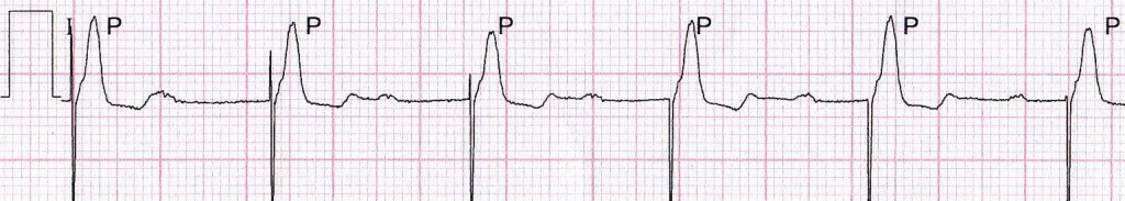 ecg-22-genn1-1024x183