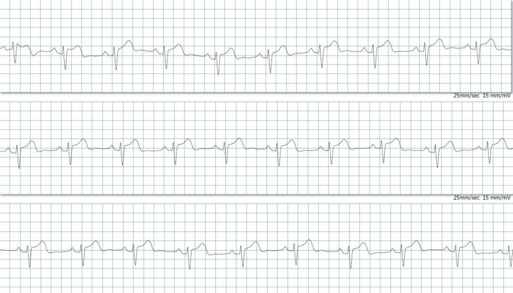 ecg-31-gen-1-1024x586