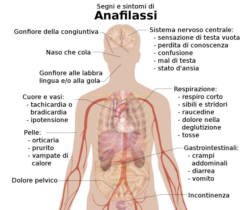 Sintomi-shock-anafilattico