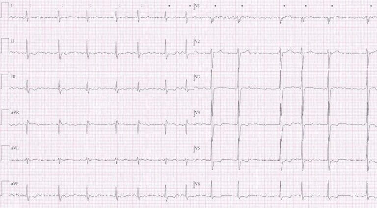 ecg-test1