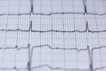 ecg-2270728_1280