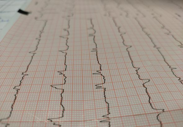 electrocardiogram-6821777_1280